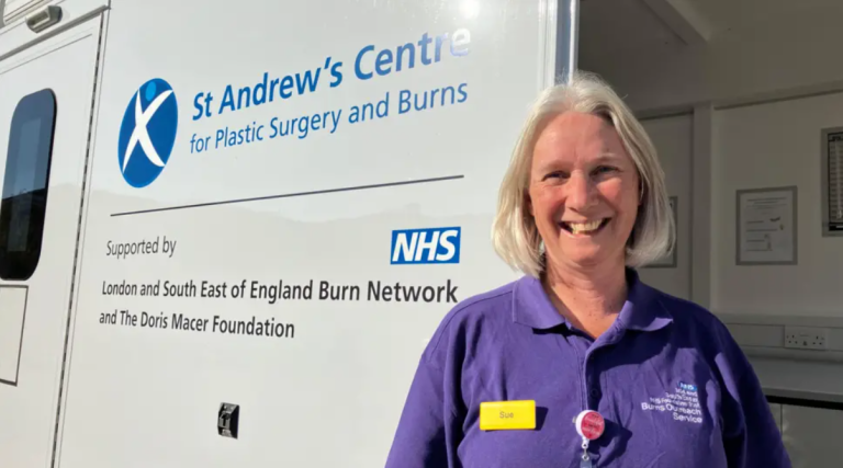 UK’s first burns bus reduces health inequalities