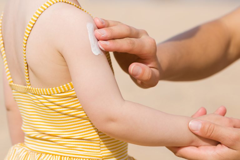 Broomfield Hospital Clinicians Urge Parents to Protect Children from Sunburn