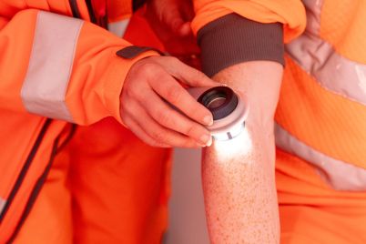 Checking-the-skin-of-a-worker-at-Sizewell-C.jpg